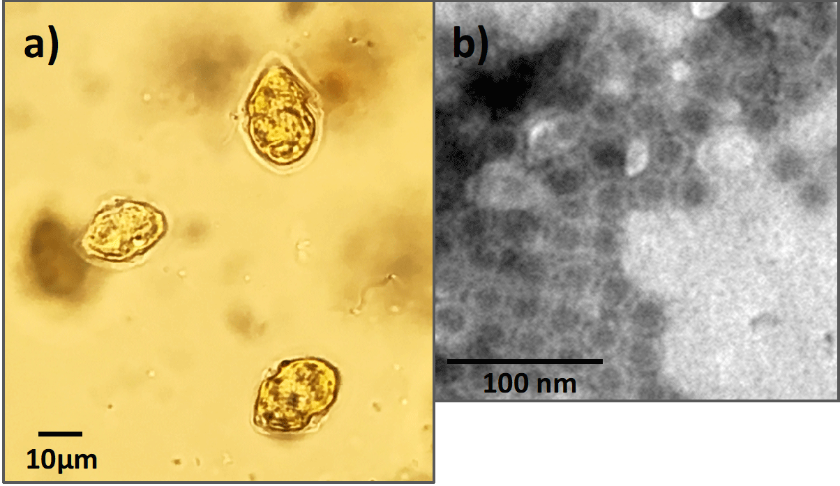 図1 a) ヘテロカプサ・サーキュラリスカーマ， b) HcRNAV μmは1/1000mm, nmは1/1000μm