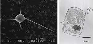 キートセロスの電子顕微鏡画像。珪藻細胞では、細胞から４本の棘毛が伸びている。