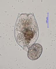 平均被甲長255µm、被甲幅165ｍのL型奄美株のワムシ