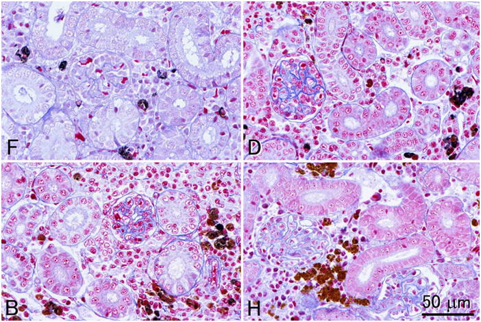 4種類の異なる固定液で固定された腎組織の切片にアザン染色を施して比較した組織の顕微鏡画像