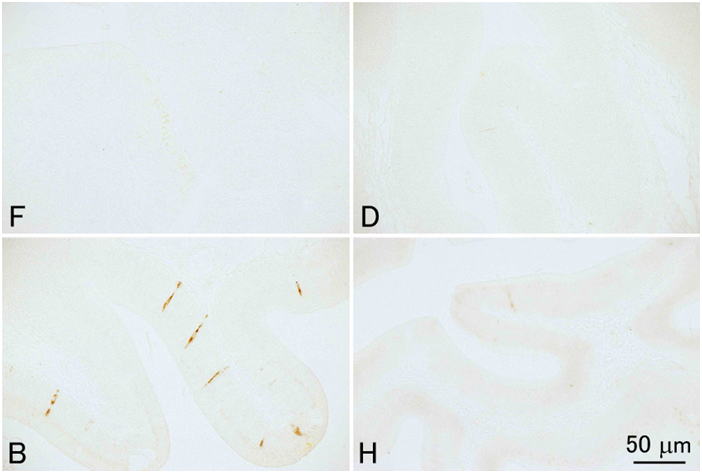 4種類の異なる固定液で固定されたヒラメ腸管上皮のコレシストキニンの免疫組織化学染色した組織の顕微鏡画像