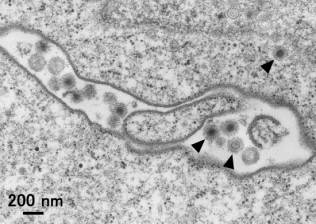 コイ培養細胞中のKHV感染粒子の電子顕微鏡写真